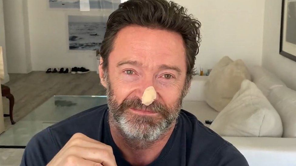 A picture of Hugh Jackman